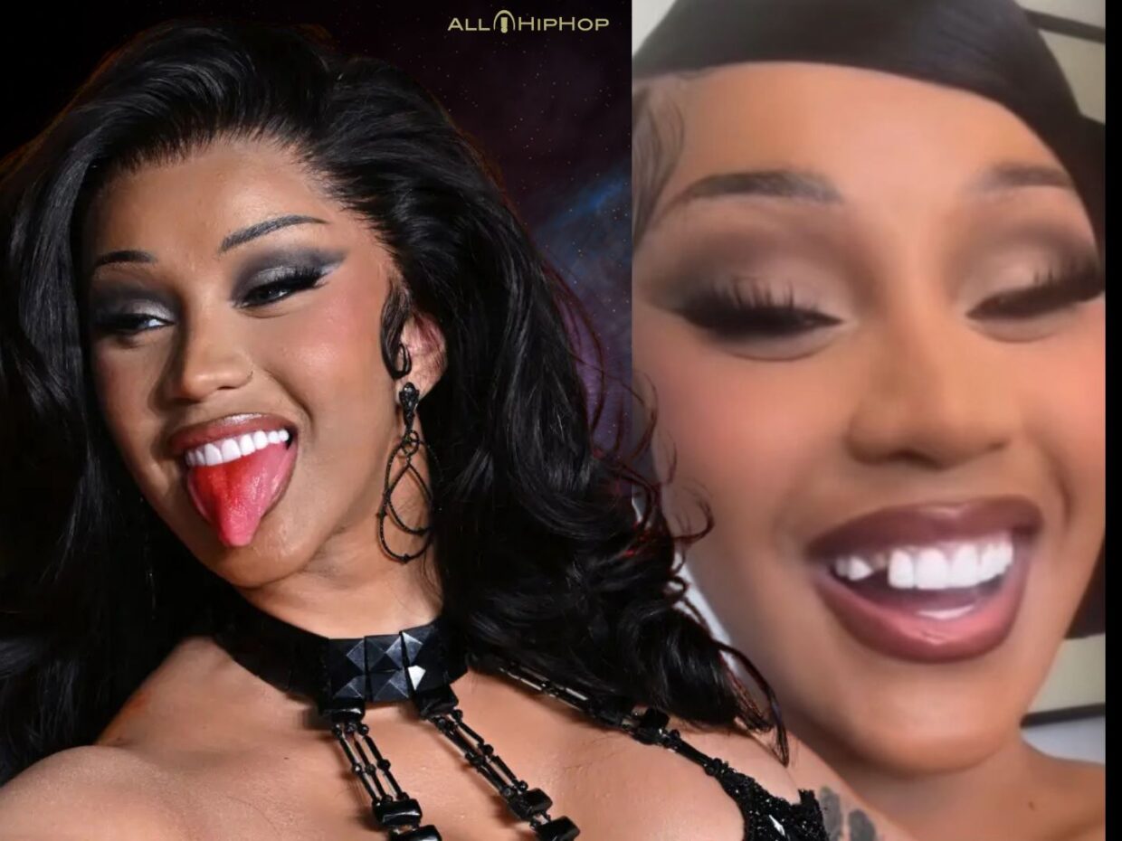 Cardi B gets her tooth fixed and her dentist explains what went wrong with her veneer